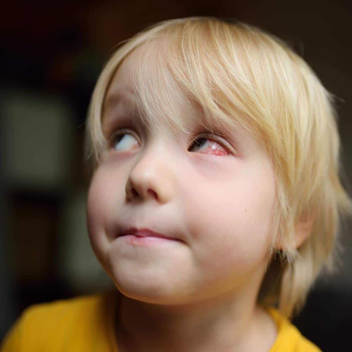 bleeding eyes spiritual meaning