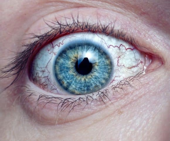 Spiritual Meaning Of Broken Blood Vessel In EYE Awakening State