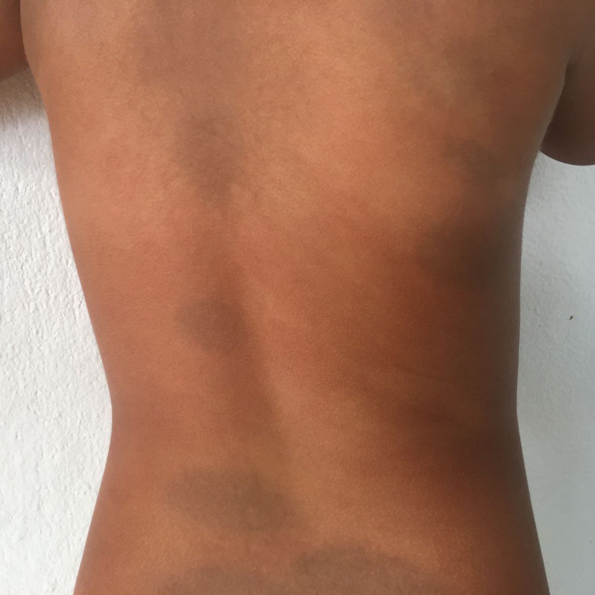 mongolian birthmark meaning