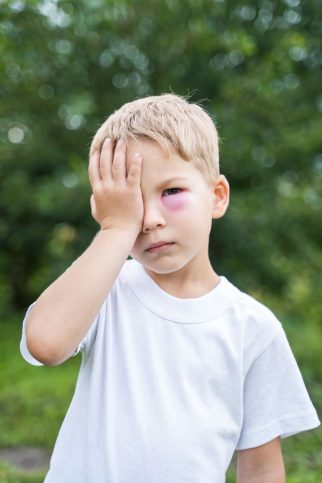 Bee Sting: Spiritual Meaning - Awakening State