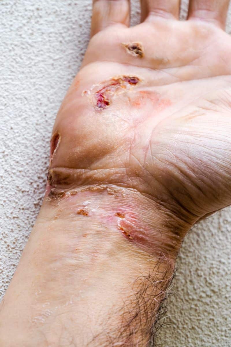 The Spiritual Meaning of Getting an Electric Shock