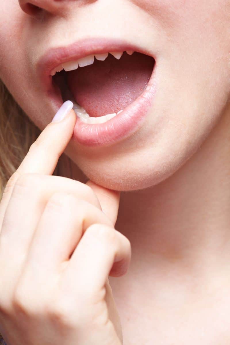 Broken Teeth Dream Spiritual Meaning